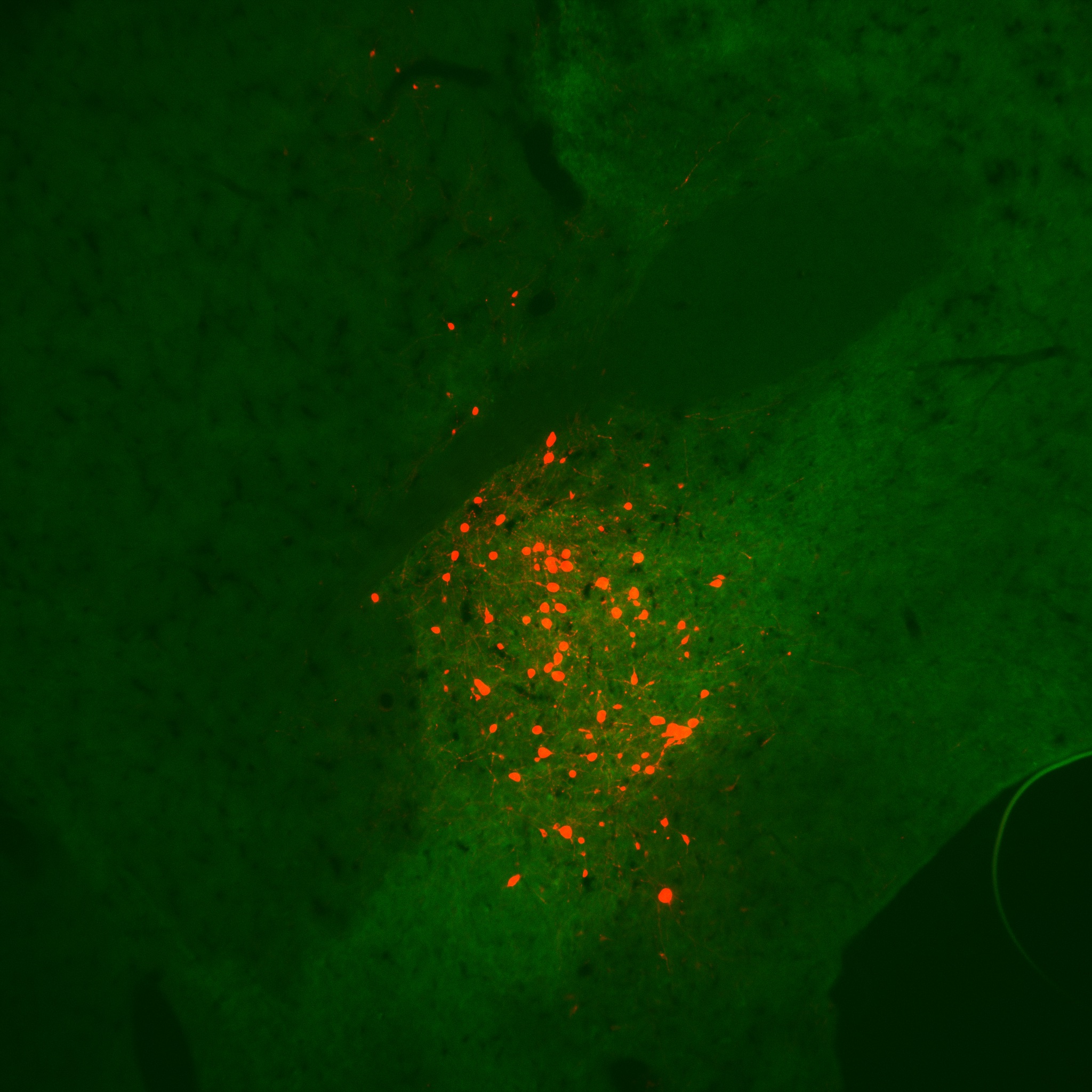 Addgene: AAV Data Hub - pAAV-hSyn-DIO-mCherry in Rat (AAV2)
